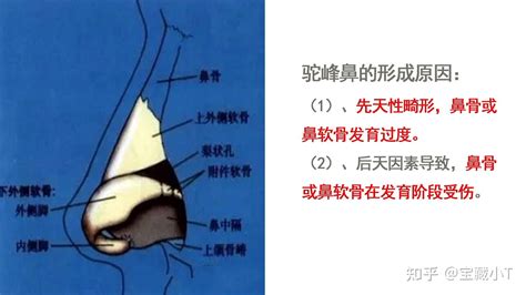 鼻挺 面相|十五种鼻型，你属于哪一种？